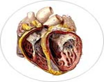 http://my.cardiovalens.com/articles/images/disease%20of%20heart%20muscle.jpg