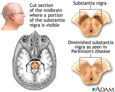 Substantia nigra and Parkinson's disease